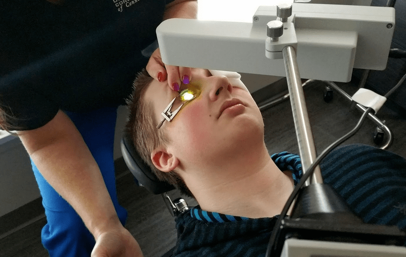 Crosslinking effectively eliminates keratoconus at the beginning of its development
